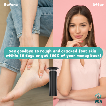 Kelly - Foot Callus Remover