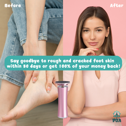 Kelly - Foot Callus Remover